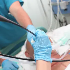 Lekarz w niebieskich rękawiczkach wykonuje bronchoskopię pacjentowi podłączonemu do respiratora.
