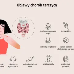 Objawy chorób tarczycy: wahania wagi, sucha skóra, łamliwe paznokcie, problemy żołądkowe, wysoki cholesterol, ból gardła, męczenie, zaburzenia rytmu serca, wahania ciśnienia, utrata włosów, problemy z pamięcią, bóle mięśni. Niedobór tyroksyny może powo...