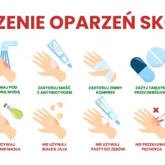 Ilustracja pokazuje leczenie oparzeń skóry: chłodna woda, maść z antybiotykiem, zimny kompres, tabletki przeciwbólowe, sok z aloesu. Unikaj masła, jajka, pasty do zębów, lodu.