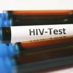 Probówki z oznaczeniem "HIV-Test" i ciemnym płynem. Wczesne wykrycie wirusa pozwala na monitorowanie objawów i wdrożenie leczenia.