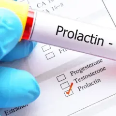 Jak badać prolaktynę, aby uzyskać wiarygodne wyniki?