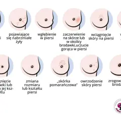 Ilustracja pokazuje różne zmiany w piersiach, w tym wyciek z brodawki, zaczerwienienie, wgłębienie, guzek, zmiany skórne i zrogowacenie. Ważne jest, by zwracać uwagę na sutki.