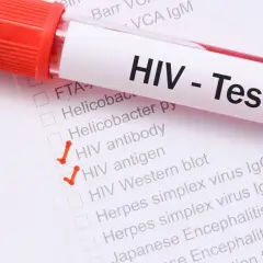 HIV po jakim czasie badania? Dowiedz się, kiedy test jest wiarygodny