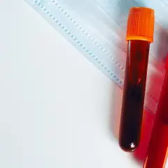 Dwie probówki z krwią na tle maseczki medycznej. Wyniki badań, w tym egfr norma, czekają na analizę.