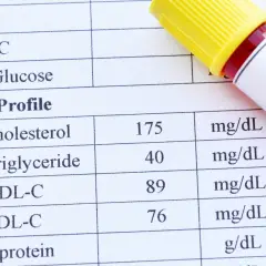 Wyniki lipidogramu: cholesterol 175, trójglicerydy 40, HDL-C 89, LDL-C 76 mg/dL. To ważne badanie, by sprawdzić lipidogram co to znaczy dla zdrowia.