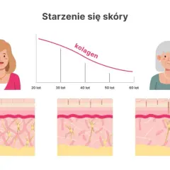 Niedobór kolagenu objawy: jak rozpoznać skutki braku kolagenu