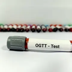 Probówki z krwią do badania OGTT, czyli krzywa cukrowa. W tle rząd innych próbek.