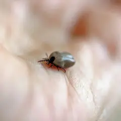 Kleszcz na dłoni, który może być przyczyną boreliozy. Czas na test.