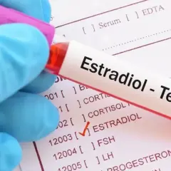 Ręka w niebieskiej rękawiczce trzyma probówkę z napisem "Estradiol - Test". Na papierze obok zaznaczono "ESTRADIOL".