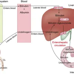 Schemat przedstawia obieg bilirubiny w organizmie, od rozpadu hemoglobiny w układzie siateczkowo-śródbłonkowym, przez transport we krwi, metabolizm w wątrobie (z udziałem UGT1A1 i OATP1B1), wydalanie z żółcią i krążenie wątrobowo-jelitowe, aż po przemi...