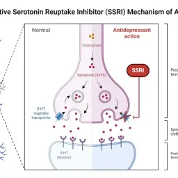 Ilustracja pokazuje działanie SSRI leków. Blokują one transporter serotoniny, zwiększając jej dostępność w synapsie.