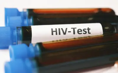 Probówki z oznaczeniem "HIV-Test" i ciemnym płynem. Wczesne wykrycie wirusa pozwala na monitorowanie objawów i wdrożenie leczenia.