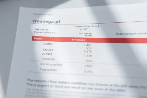 Podwyższony poziom PDW we krwi – co to oznacza dla zdrowia?