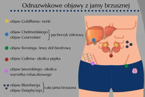 Objaw Jaworskiego, wskazujący na zapalenie wyrostka robaczkowego, zaznaczony jest na grafice w okolicy wyrostka.