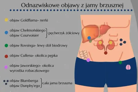 Ilustracja pokazuje lokalizację objawów brzusznych, w tym objaw Jaworskiego, który wskazuje, gdzie boli wyrostek robaczkowy.