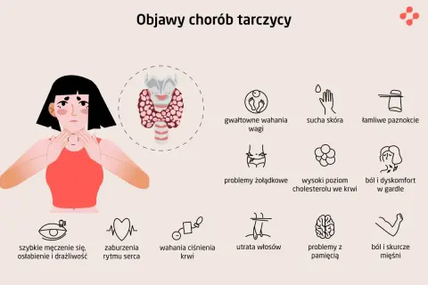Objawy chorób tarczycy: wahania wagi, sucha skóra, łamliwe paznokcie, problemy żołądkowe, wysoki cholesterol, ból gardła, męczenie, zaburzenia rytmu serca, wahania ciśnienia, utrata włosów, problemy z pamięcią, bóle mięśni. Niedobór tyroksyny może powo...