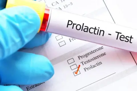 Jak badać prolaktynę, aby uzyskać wiarygodne wyniki?