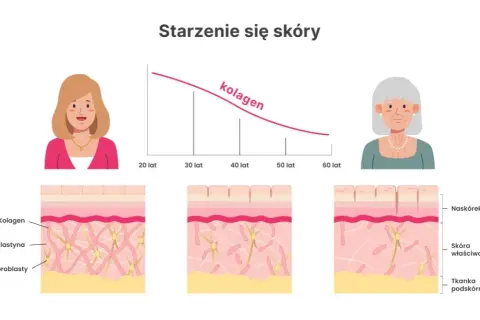 Niedobór kolagenu objawy: jak rozpoznać skutki braku kolagenu