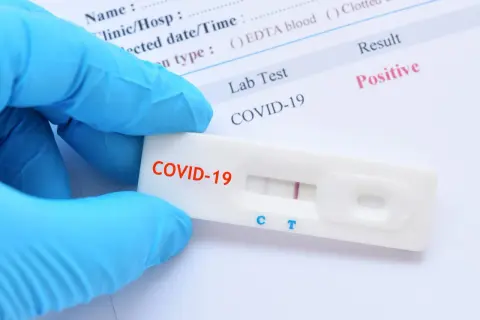 Ręka w niebieskiej rękawiczce trzyma test antygenowy COVID-19 z dwoma widocznymi paskami, wskazującymi na pozytywny wynik.