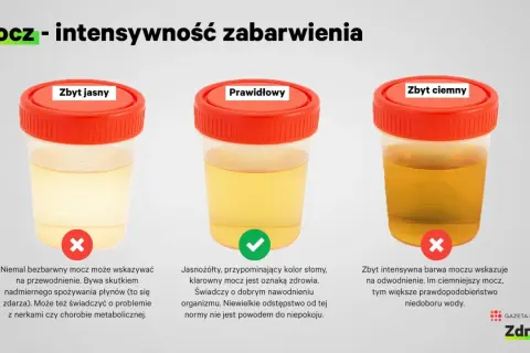 Trzy próbki moczu: zbyt jasny (może oznaczać przewodnienie lub problemy z nerkami), prawidłowy (jasnożółty, jak słoma, świadczy o dobrym nawodnieniu) i zbyt ciemny (wskazuje na odwodnienie).