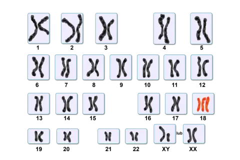 Kariotyp przedstawia pary chromosomów, w tym wyróżniające się czerwone chromosomy.