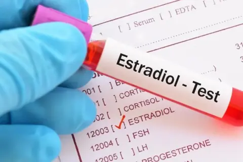 Ręka w niebieskiej rękawiczce trzyma probówkę z napisem "Estradiol - Test". Na papierze obok zaznaczono "ESTRADIOL".