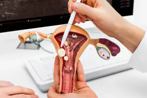 Model macicy z widocznymi mięśniakami. Lekarz wskazuje na nie, omawiając diagnozę.