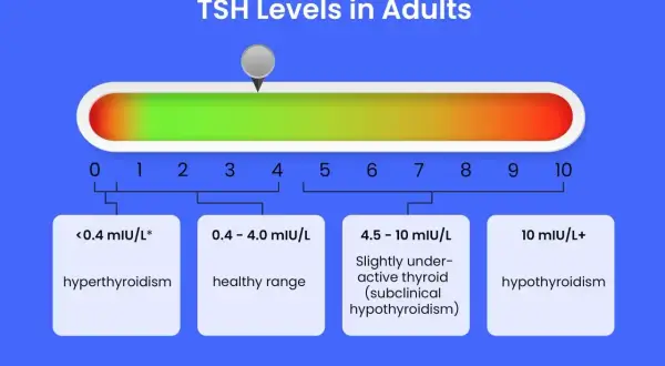 Wykres TSH Levels in Adults pokazuje, że ft3 co to za badanie, gdy poziom TSH jest poniżej 0.4 mIU/L, oznacza nadczynność tarczycy.