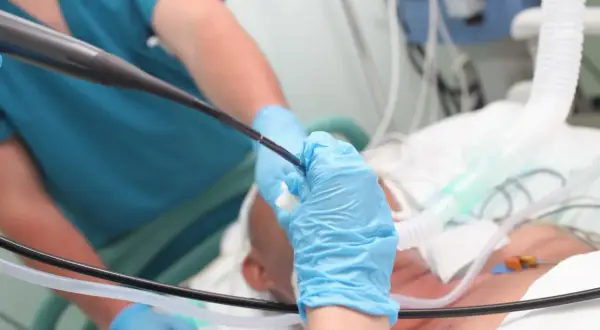 Lekarz w niebieskich rękawiczkach wykonuje bronchoskopię pacjentowi podłączonemu do respiratora.