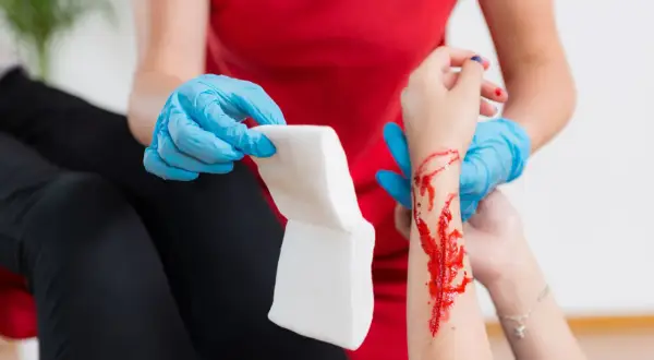 Opatrunek na ręce z raną, która może być objawem hemofilii. Osoba w niebieskich rękawiczkach przygotowuje gazę.