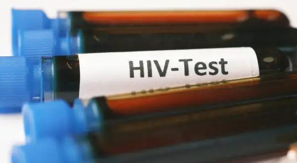 Probówki z oznaczeniem "HIV-Test" i ciemnym płynem. Wczesne wykrycie wirusa pozwala na monitorowanie objawów i wdrożenie leczenia.