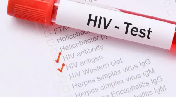 HIV po jakim czasie badania? Dowiedz się, kiedy test jest wiarygodny