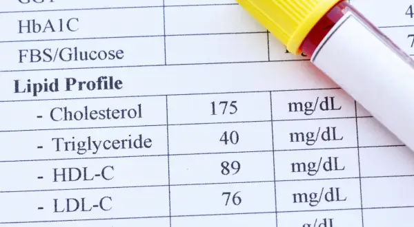 Wyniki lipidogramu: cholesterol 175, trójglicerydy 40, HDL-C 89, LDL-C 76 mg/dL. To ważne badanie, by sprawdzić lipidogram co to znaczy dla zdrowia.