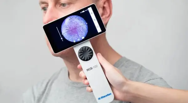 Badanie skóry twarzy za pomocą wideodermatoskopu. Urządzenie RCS-100 pozwala na szczegółową analizę zmian skórnych.