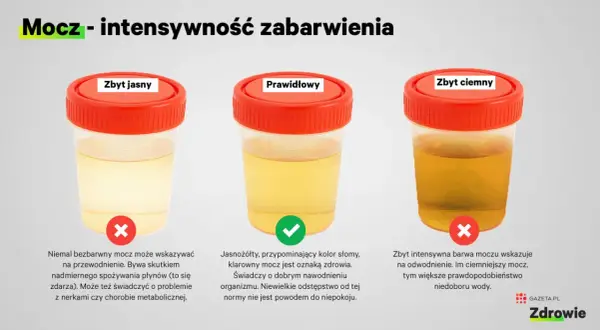 Trzy próbki moczu: zbyt jasny (może oznaczać przewodnienie lub problemy z nerkami), prawidłowy (jasnożółty, jak słoma, świadczy o dobrym nawodnieniu) i zbyt ciemny (wskazuje na odwodnienie).