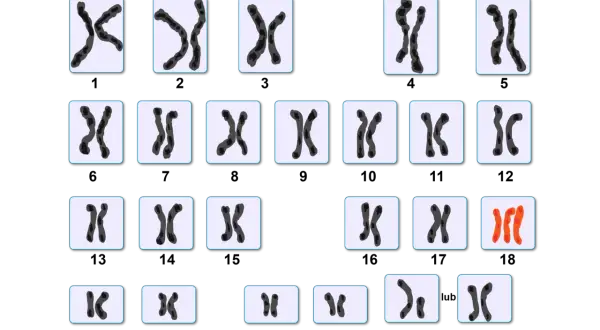 Kariotyp przedstawia pary chromosomów, w tym wyróżniające się czerwone chromosomy.