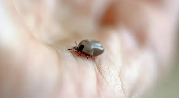 Kleszcz na dłoni, który może być przyczyną boreliozy. Czas na test.