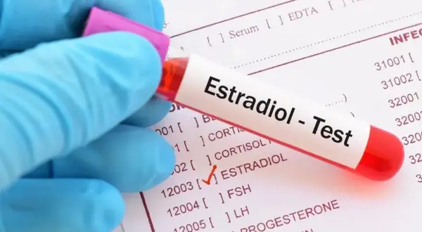 Ręka w niebieskiej rękawiczce trzyma probówkę z napisem "Estradiol - Test". Na papierze obok zaznaczono "ESTRADIOL".