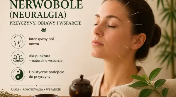 Kobieta z igłami akupunkturowymi na twarzy, symbolizującymi ulgę w nerwobólach (neuralgii). Holistyczne podejście do przyczyn bólu.