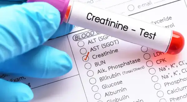 Rękawiczka w niebieskiej rękawiczce trzyma probówkę z napisem "Creatinine - Test". Obok zaznaczono "Creatinine", co sugeruje badanie poziomu kreatyniny w celu sprawdzenia, czy mieści się w kreatynina norma.