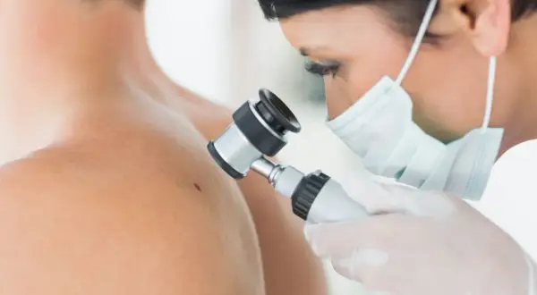 Lekarz w masce i rękawiczkach wykonuje dermatoskopię znamienia na ramieniu pacjenta.