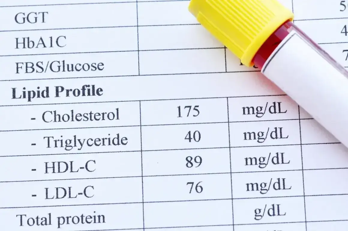 Wynik lipidogramu: cholesterol całkowity 175, triglicerydy 40, HDL-C 89, LDL-C 76. Wynik ten pomaga ocenić ryzyko chorób serca, uwzględniając cholesterol nie-HDL.