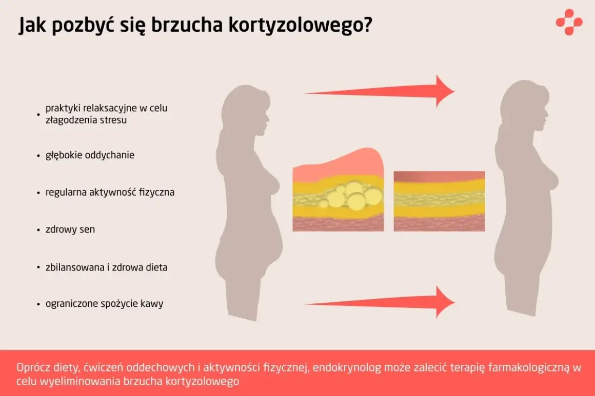 Grafika pokazuje, jak pozbyć się brzucha kortyzolowego poprzez relaks, ćwiczenia, sen i dietę. Zmniejsza się warstwa tłuszczu.