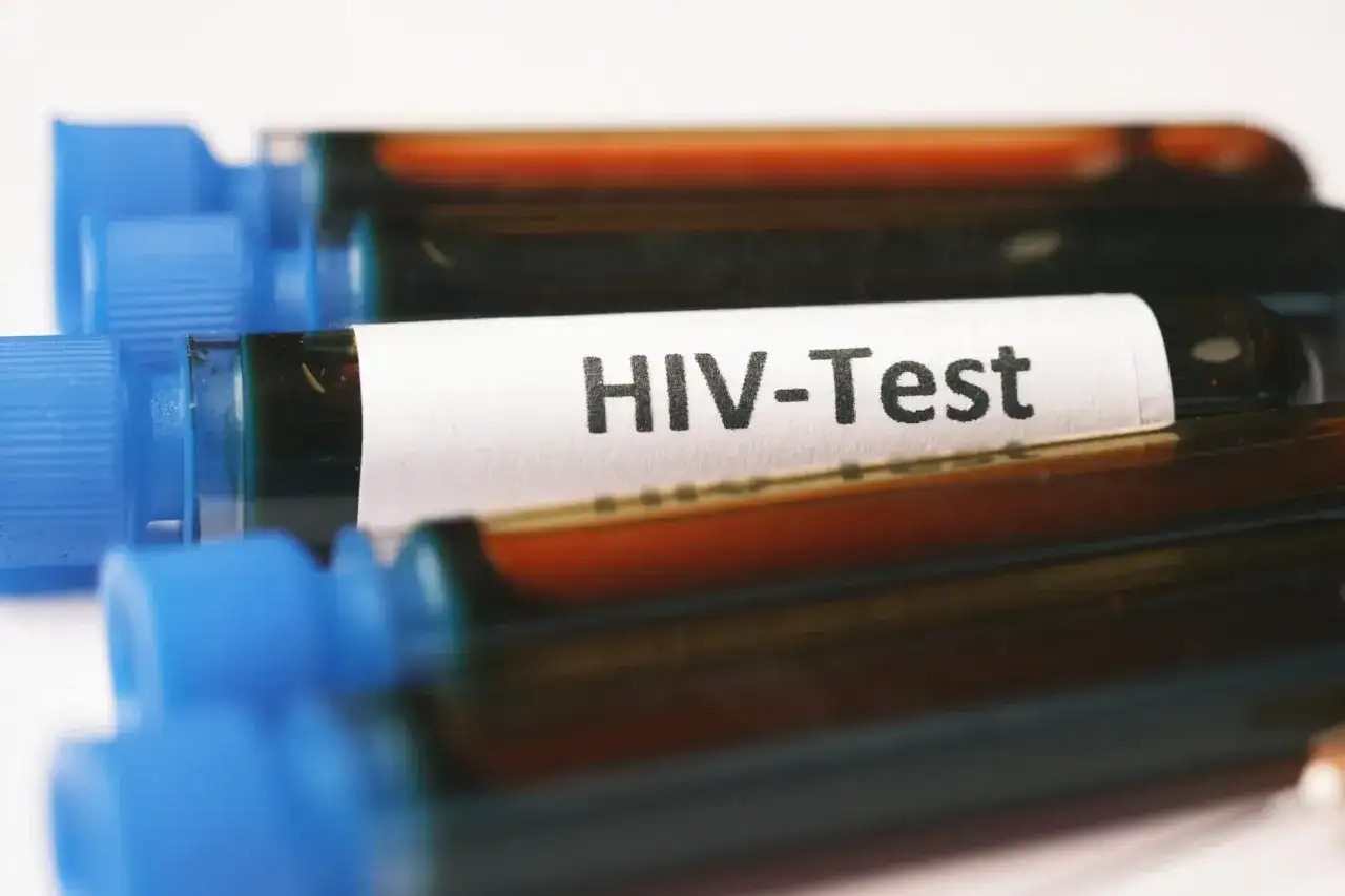 Objawy HIV - kiedy zrobić test i co zrobić po kontakcie?