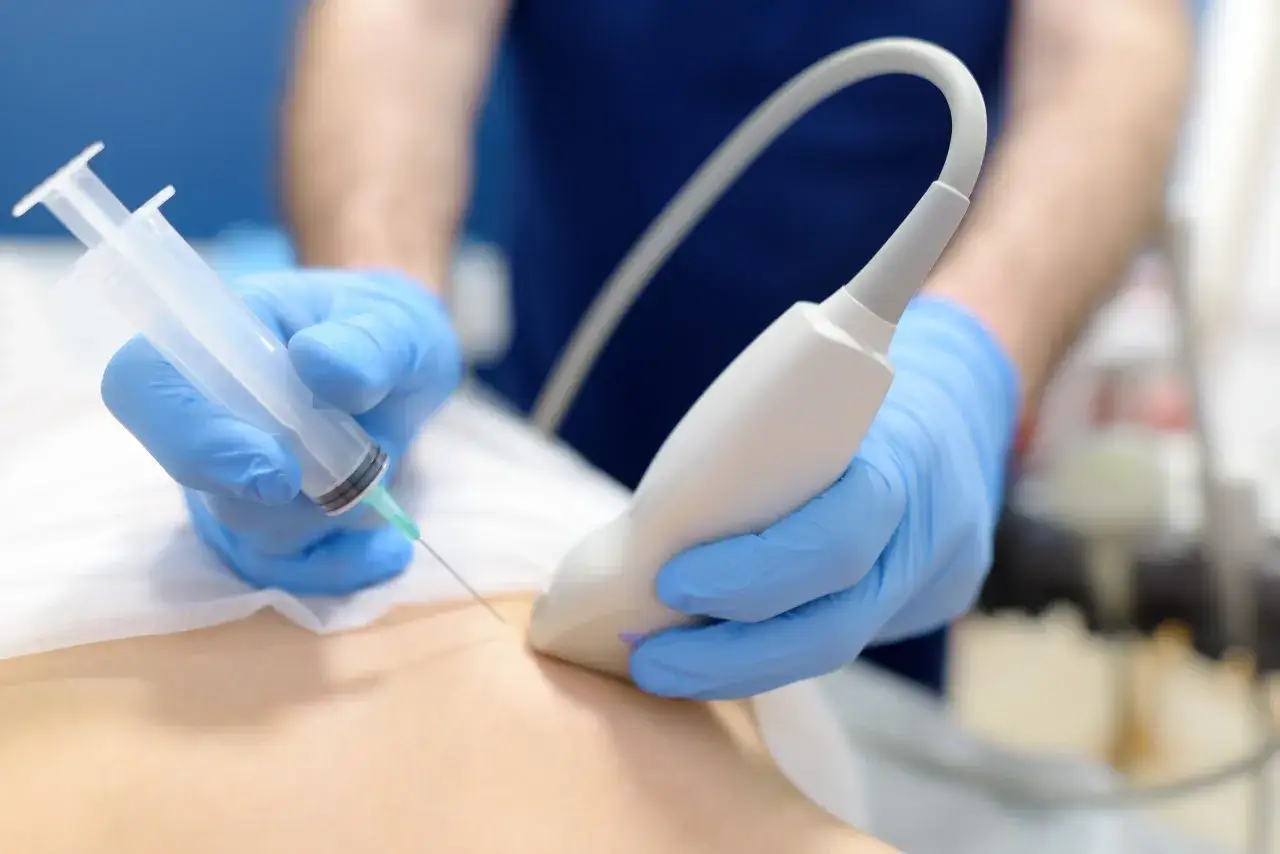 Lekarz w niebieskich rękawiczkach wykonuje biopsję gruboigłową piersi, używając aparatu USG i strzykawki.