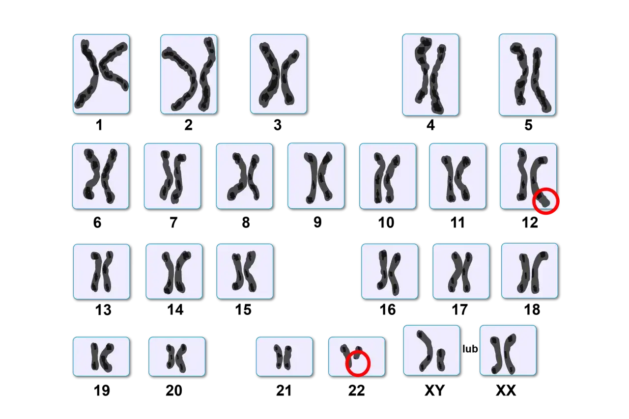 Kariotyp przedstawia pary chromosomów, w tym chromosomy płci X i Y. Jeden z chromosomów jest zaznaczony czerwonym kółkiem.