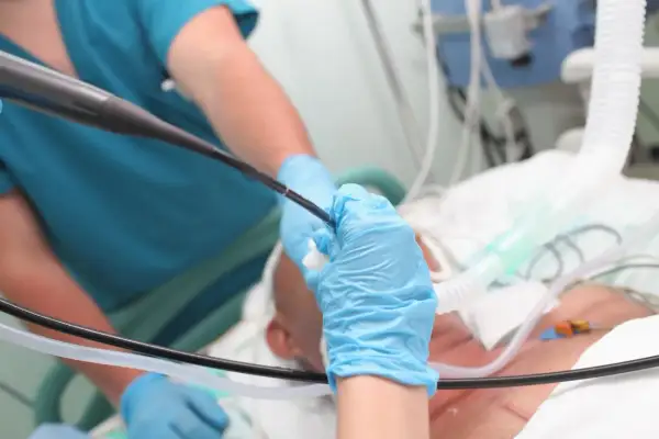 Lekarz w niebieskich rękawiczkach wykonuje bronchoskopię pacjentowi podłączonemu do respiratora.