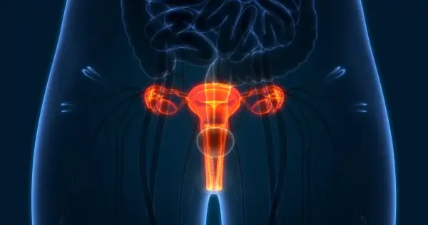 Anatomia kobiecych narządów rozrodczych, w tym macicy, jajników i jajowodów. Obraz może ilustrować proces histerektomii.