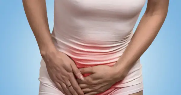 Kobieta trzyma się za brzuch, odczuwając ból w pachwinie promieniujący na nogę. Czerwony obszar wskazuje na dolegliwość.