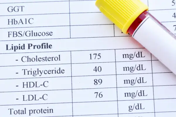 Wyniki lipidogramu: cholesterol 175, trójglicerydy 40, HDL-C 89, LDL-C 76 mg/dL. To ważne badanie, by sprawdzić lipidogram co to znaczy dla zdrowia.